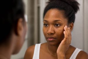 Masque de grossesse peau noire : causes, traitements et astuces pour l’atténuer