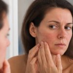Allergie cosmétique visage : causes, symptômes et solutions pour la peau du visage