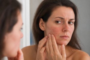 Allergie cosmétique visage : causes, symptômes et solutions pour la peau du visage